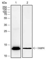 Anti-Rat/Mouse FABP4 Antibody [A487]