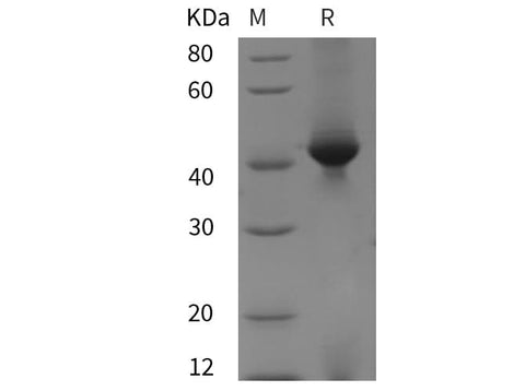 SDS-PAGE analysis of Mouse CHI3L1/YKL40 proteins, 2 μg/lane of Recombinant Mouse CHI3L1/YKL40 proteins was resolved with SDS-PAGE under reducing conditions, showing bands at 42 kDa.