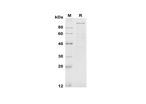 SDS-PAGE analysis of Mouse E-Cadherin proteins, 2 μg/lane of Recombinant Mouse E-Cadherin proteins was resolved with SDS-PAGE under reducing conditions, showing bands at 100 kDa.