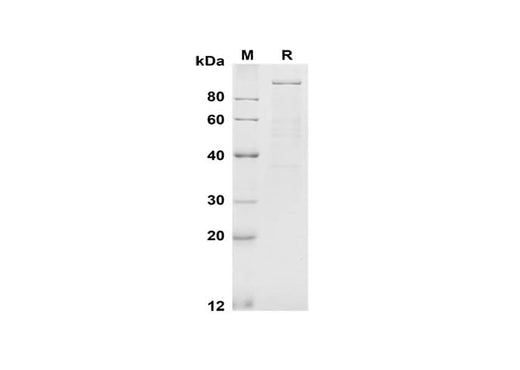 SDS-PAGE analysis of Mouse E-Cadherin proteins, 2 μg/lane of Recombinant Mouse E-Cadherin proteins was resolved with SDS-PAGE under reducing conditions, showing bands at 100 kDa.