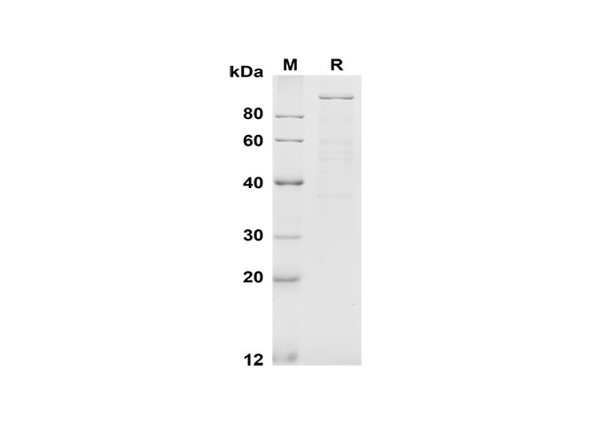 SDS-PAGE analysis of Mouse E-Cadherin proteins, 2 μg/lane of Recombinant Mouse E-Cadherin proteins was resolved with SDS-PAGE under reducing conditions, showing bands at 100 kDa.
