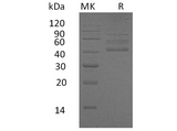 Recombinant Human RELT/TNFRSF19L Protein (Fc Tag) - ABMIUM