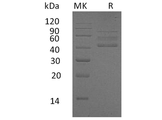Recombinant Human RELT/TNFRSF19L Protein (Fc Tag) - ABMIUM
