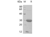 SDS-PAGE analysis of Mouse CD74 proteins, 2 μg/lane of Recombinant Mouse CD74 proteins was resolved with SDS-PAGE under reducing conditions, showing bands at 26-32 kDa.