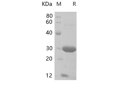 SDS-PAGE analysis of Mouse CD74 proteins, 2 μg/lane of Recombinant Mouse CD74 proteins was resolved with SDS-PAGE under reducing conditions, showing bands at 26-32 kDa.
