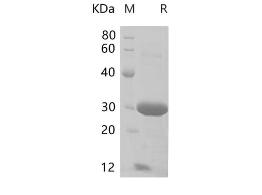 SDS-PAGE analysis of Mouse CD74 proteins, 2 μg/lane of Recombinant Mouse CD74 proteins was resolved with SDS-PAGE under reducing conditions, showing bands at 26-32 kDa.