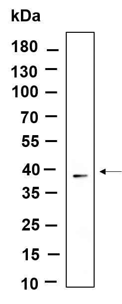 Anti-Human/Mouse/Rat Nucleophosmin Antibody [B877] - ABMIUM