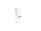 Anti-Human PKM2 Antibody - ABMIUM