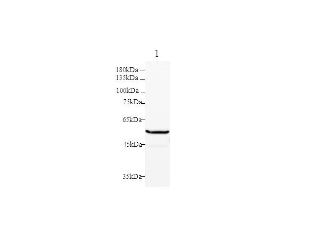 Anti-Human PKM2 Antibody - ABMIUM