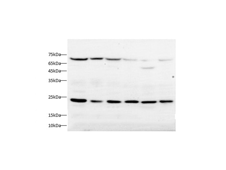 Anti-Human/Mouse/Rat TIMP-2/TIMP2 Antibody - ABMIUM