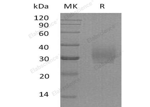 Recombinant Human Syndecan-2/SDC2 Protein (His Tag) - ABMIUM