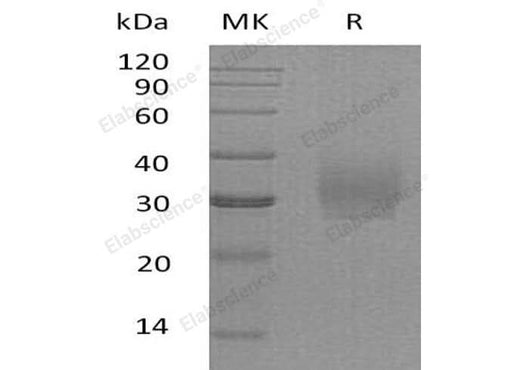 Recombinant Human Syndecan-2/SDC2 Protein (His Tag) - ABMIUM