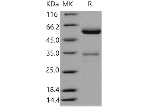 > 94 % as determined by reducing SDS-PAGE.