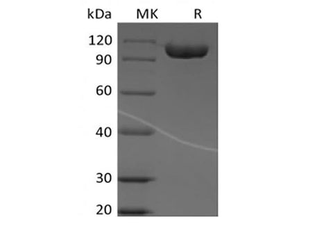 Recombinant Human Immunoglobulin Superfamily Member 8/IGSF8/CD316 (C-Fc) - ABMIUM
