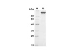 SDS-PAGE analysis of Human APN proteins, 2 μg/lane of Recombinant Human APN proteins was resolved with SDS-PAGE under reducing conditions, showing bands at 120-130 kDa.