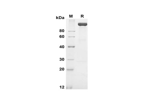 SDS-PAGE analysis of Human APN proteins, 2 μg/lane of Recombinant Human APN proteins was resolved with SDS-PAGE under reducing conditions, showing bands at 120-130 kDa.