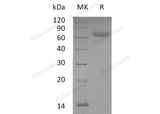 Recombinant Mouse ANGPTL4 Protein (Fc Tag) - ABMIUM