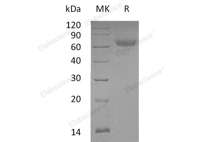 Recombinant Mouse ANGPTL4 Protein (Fc Tag) - ABMIUM