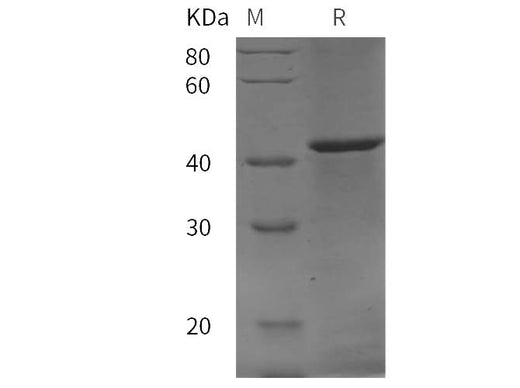 SDS-PAGE analysis of Rat Prostatic Acid Phosphatase/ACPP proteins, 2 μg/lane of Recombinant Rat Prostatic Acid Phosphatase/ACPP proteins was resolved with SDS-PAGE under reducing conditions, showing bands at 43 kDa.