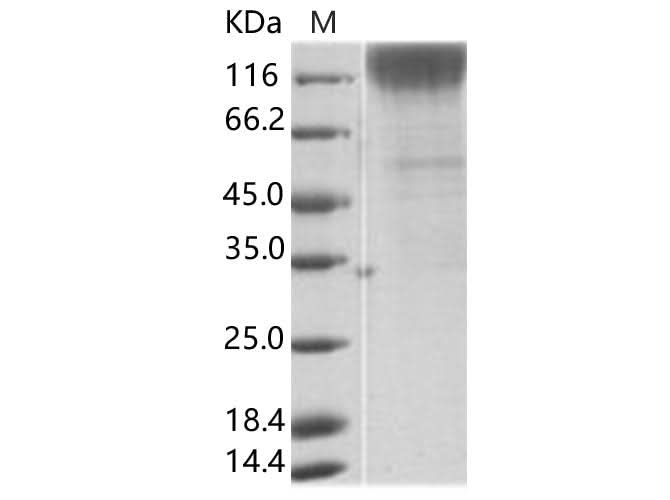 Recombinant SIV (isolate 216.94.A2) gp120 Protein (His Tag) - ABMIUM