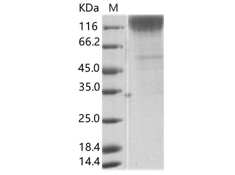 Recombinant SIV (isolate 216.94.A2) gp120 Protein (His Tag) - ABMIUM
