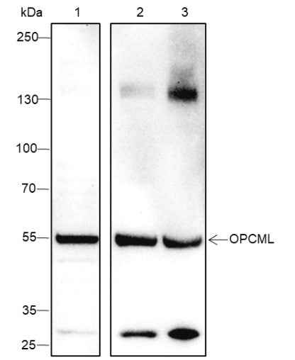 Anti-Human/Rat/Mouse OPCML Antibody [A316] - ABMIUM