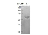 Recombinant Human SULT1C2 Protein (His Tag) - ABMIUM
