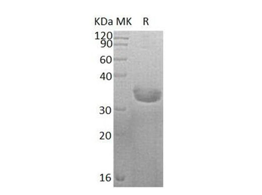 Recombinant Human SULT1C2 Protein (His Tag) - ABMIUM
