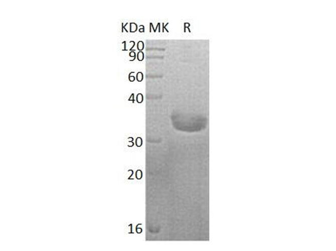 Recombinant Human SULT1C2 Protein (His Tag) - ABMIUM