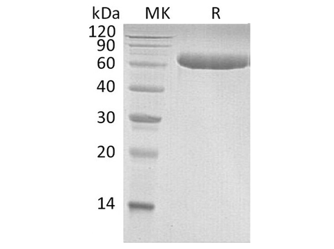 Recombinant Human LBP Protein (His Tag) - ABMIUM