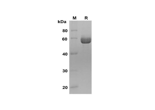 SDS-PAGE analysis of Human AMY1A proteins, 2 μg/lane of Recombinant Human AMY1A proteins was resolved with SDS-PAGE under reducing conditions, showing bands at 55-60 kDa.