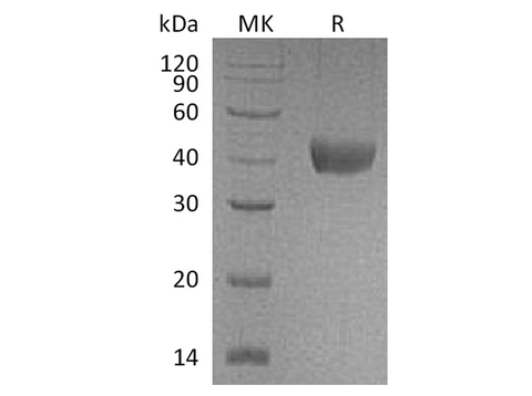 Recombinant Cynomolgus CD38/ADP-ribosyl Cyclase 1 Protein (His Tag) - ABMIUM