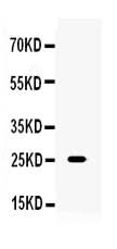 Anti-TNF alpha Antibody Picoband® Boster Bio