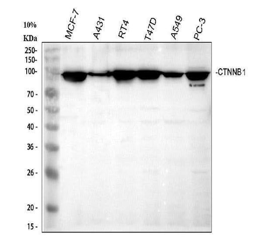 Anti-beta Catenin/CTNNB1 Antibody Picoband® Boster Bio