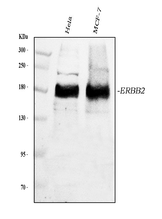 Anti-ErbB 2/ERBB2 Antibody Picoband® Boster Bio