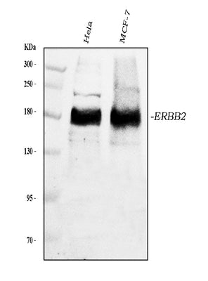 Anti-ErbB 2/ERBB2 Antibody Picoband® Boster Bio