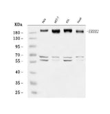 Anti-HER2/ERBB2 Antibody Picoband® Boster Bio