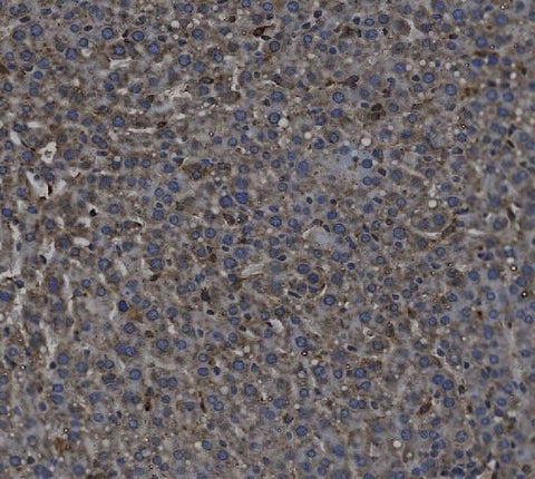 Anti-TGF beta 1/TGFB1 Antibody Boster Bio