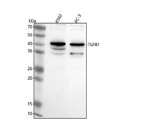 Anti-TGFB1 Antibody Picoband® Boster Bio