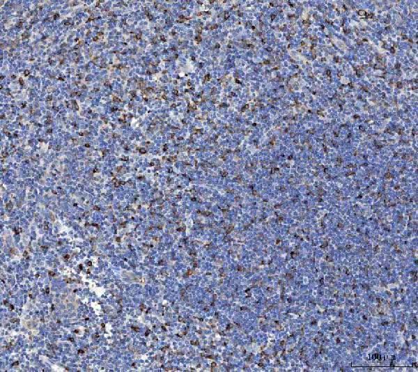 Anti-IL-10/IL10 Antibody Boster Bio