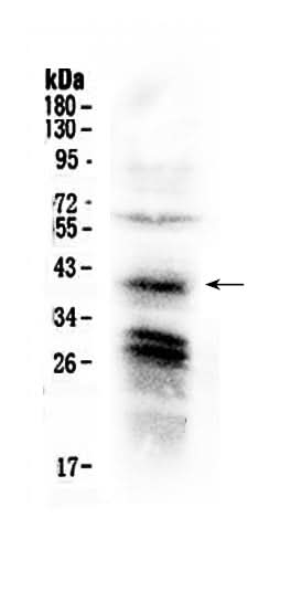 Anti-CXCR4 Antibody Picoband® Boster Bio
