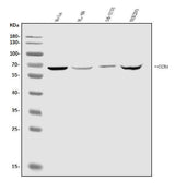 Anti-CXCR4 Antibody Picoband® Boster Bio