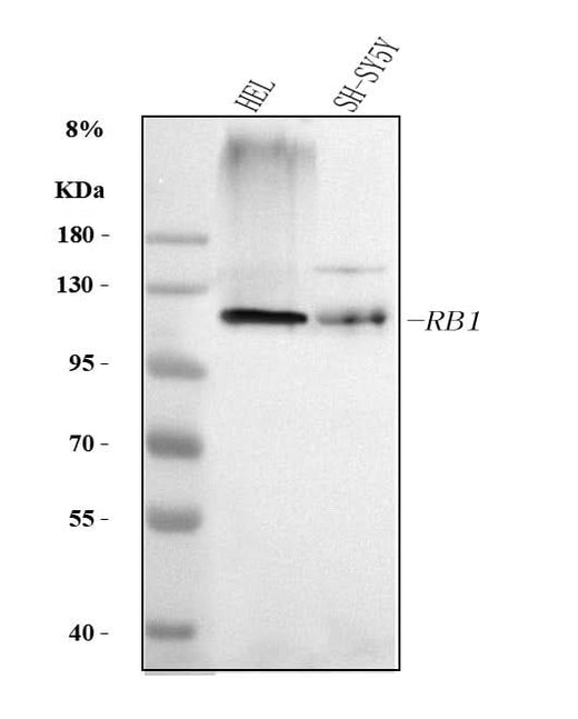 Anti-RB1 Antibody Picoband® Boster Bio