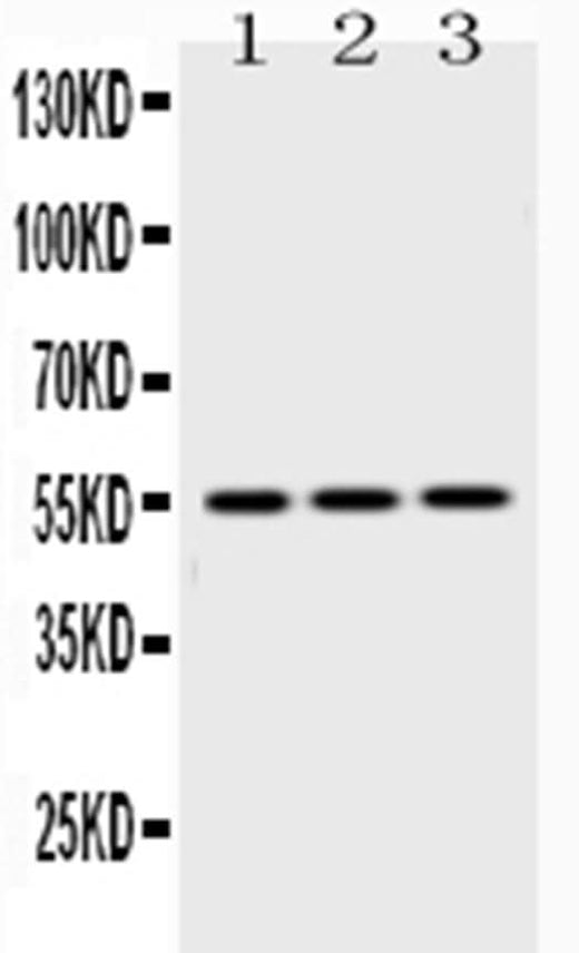 Anti-Caspase 8/CASP8 Antibody Picoband® Boster Bio