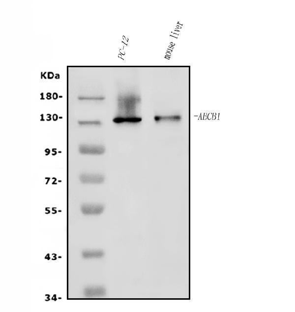 Anti-P Glycoprotein/ABCB1 Antibody Picoband® Boster Bio