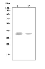Anti-CCR5 Picoband® Antibody Boster Bio