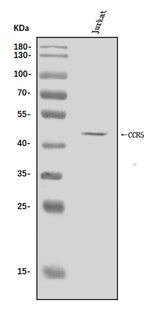 Anti-CCR5 Antibody Picoband® Boster Bio