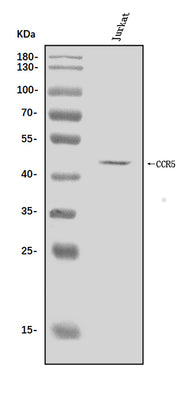 Anti-CCR5 Antibody Picoband® Boster Bio