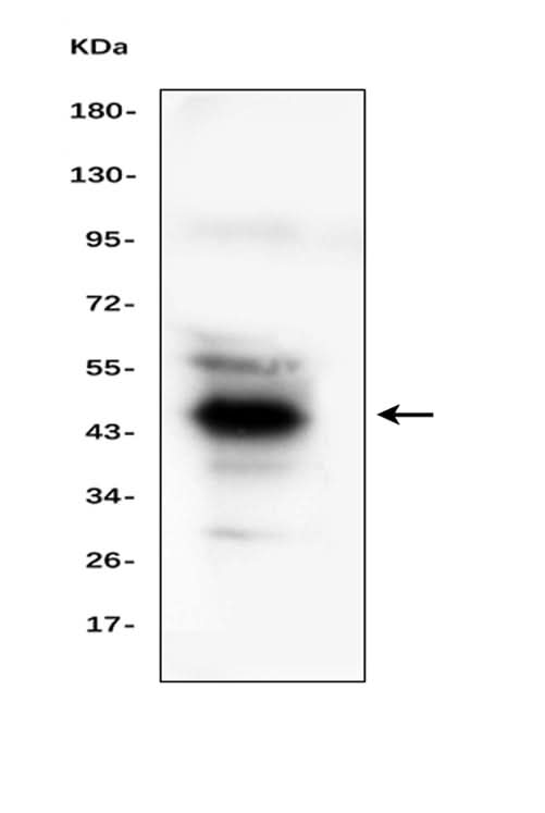 Anti-Haptoglobin/HP Antibody Picoband® Boster Bio