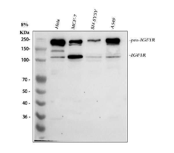 Anti-IGF1R Antibody Picoband® Boster Bio
